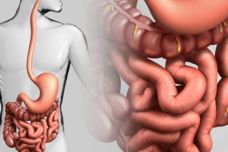 Աղիների համար 3 ամենաօգտակար մթերքները