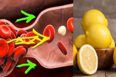 Մթերքներ, որոնք նոսրացնում են արյունը և պաշտպանում վարիկոզից