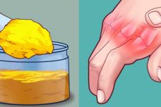 Այս բնական քսուքը կօգնի վերացնել արթրիտը, ազատվել ռևմատիզմից և մոռանալ հոդացավերի մասին Այս բնական քսուքը կօգնի վերացնել արթրիտը, ազատվել ռևմատիզմից և մոռանալ հոդացավերի մասին