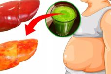 Ինչպես նվազեցնել լյարդի ճարպը