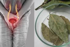 Ազատվել եմ ցիստիտ դափնու տերևի միջոցով․ Ահա գաղտնիքը