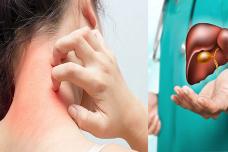 Բժիշկը նշել է հիվանդ լյարդի առաջին նշանները․ Այն կարելի է տեսնել անզեն աչքով