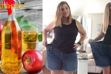 56 տարեկանում նիհարել եմ և փորիս մաշկը ձգվել է շնորհիվ այս բաղադրատոմսի. Բաղադրատոմսը թողնում եմ մեկնաբանության մեջ