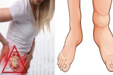 Ուշադրություն․ Նախազգուշացնող նշան, որ ձեր երիկամները հիվանդ են, պետք է շտապ այցելեք բժշկի