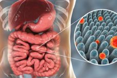 Ընդամենը 2 բաղադրիչով մաքրեք հաստ աղիքը, նիհարեք և բարակեցրեք գոտկատեղը