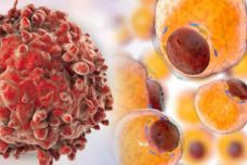 Հենց այս վիտամինն է սպանում քաղցկեղը