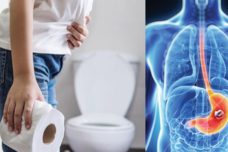 Բժիշկը ներկայացրել է ստամոքսի քաղցկեղի հիմնական ախտանիշը