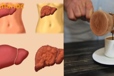 Ամենապարզ միջոցը, որ ինձ օգնեց լյարդս մաքրել ու առողջանալ․ Խորհուրդ եմ տալիս բոլորին