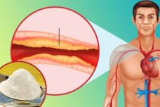 Ինչպես մաքրել անոթները խոլեստերինից