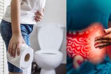 Չշփոթեք ուրիշ բանի հետ․ Սա աղիքների հիվանդության առաջին նշանն է, շտապ դեմն առեք