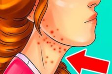 Հրաժարվեք շաքարից, եթե ունեք այս 7 խնդիրներից որևէ մեկը