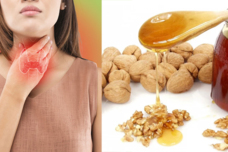 Բուժեք վահանաձև գեղձը․ Պարզապես խառնեք այս 3 բաղադրիչները և ընդուննք