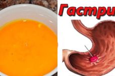Այս միջոցը արագ կազատի ստամոքսի խոցից և գաստրիտից