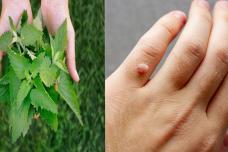 Գորտնուկները վերացրեք այս բույսով