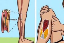 Ո՞րն է ջղաձգության հիմնական պատճառը․  Տեսեք թե ինչ է ուզում ձեզ ասել ձեր մարմինը