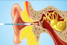 Սարսափելի է, հրաժարվեք ականջների համար բամբակյա փայտիկներ օգտագործելուց․ Ահա պատճառը