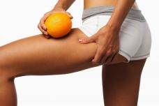 Դիետոլոգները հրապարակել են ցելյուլիտի դեմ պայքարի գլխավոր մթերքները
