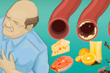 Մթերքների ցանկ, որոնք մաքրում են զարկերակները և պաշտպանում սրտի կաթվածից