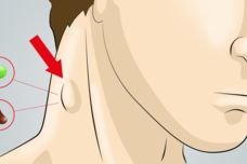 Լիմֆատիկ համակարգը մաքրելու լավագույն միջոցը․ Թուլությունը, գլխացավը և նույնիսկ ավելորդ քաշը կվերանան