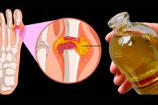 Ինչպե՞ս հանել միզաթթուն օրգանիզմից․ Լավագույն բնական տարբերակն է սա