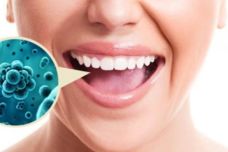 Սպանեք ձեր բերանում գտնվող բակտերիաները միայն մեկ բաղադրիչով