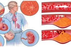 Թաքնված նշան, որը վկայում է, որ ձեր լյարդը վատ վիճակում է գտնվում