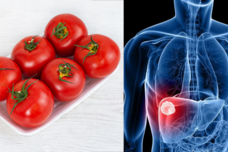 Բժիշկը չի թույլատրում լոլիկ ուտեք եթե ունեք ․․․