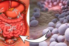Այս թեյը հեռացնում է ավշային հանգույցներում, հաստ աղիքներում և միզապարկի մեջ կուտակված տոքսինները