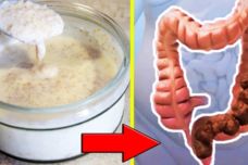 Ինչպես մաքրել աղիքներից կեղտը, նիհարել և լինել առողջ