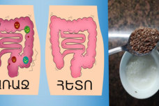 Այսպես մաքրեք ամբողջ աղիները ՝ հատկապես հաստ աղիքը և եղեք առողջ