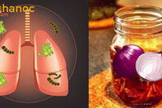 Սովորական սոխի միջոցով 100 տոկոսանոց մաքրեք ձեր թոքերը և եղեք առողջ