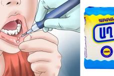 Սովորական աղի միջոցով ազատվեք ստոմատիտից․ Ահա թե ինչպես