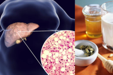 Այս համեմունքը  լցրեք կաթի մեջ և այն կբուժի ձեր լյարդը վերացնելով ճարպն ու ցավերը