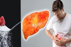 Մթերքներ, որոնք վնասում են լյարդը․ Այս ցանկը ամենավնասակար մթերքներն են լյարդի համար