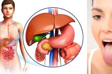 Եթե ձեր լեզվի վրա կա այս նշանը, ուրեմն լյարդի և ստամոքսի լուրջ խնդիրներ ունեք ՝ առանց ախտանիշ
