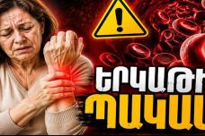 Սա երկաթի պակասի նշան է, որը շատերն անտեսում են