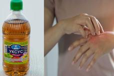 Տեսեք ինչ տհաճ խնդրից կարող եք ազատվել քացախի միջոցով․ Ափսոս շուտ չգիտեի այս մասին