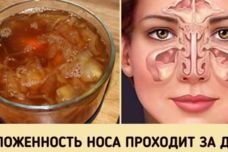 Քիթը խցանվա՞ծ է․ այս պարզ միջոցը շատերն օգտագործում են քնելուց առաջ և առավոտյան հանգիստ շնչում