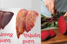 Բազուկը փոշեկուլի պես կմաքրի լյարդը․ Միայն այսպես օգտագործեք