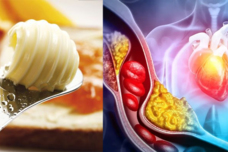 Ահա այն մթերքների ցանկը, որոնք պարունակում են ամենավատ խոլեստերինը․ Հեռու մնացեք այս մթերքներից