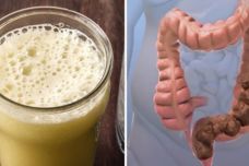 Բուժեք փորկապությունը, աղիքները և մարսողության հետ կապված խնդիրները