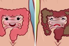 Ինչ ուտել, որպեսզի վերանա փքվածությունն ու ծանրությունը աղիներից․ Բժշկի խորհուրդը