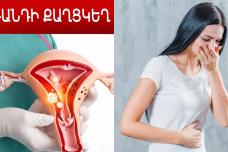 Սա արգանդի քաղցկեղի առաջին նշանն է․ Մի անտեսեք սիրելի կանայք