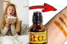 Յոդը կօգնի ձեզ ազատվել այս բարդ հիվանդությունից