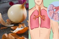 Ինչպե՞ս հեռացնել խորխը թոքերից. Այս միջոցը կօգնի նաև ազատվել հազից